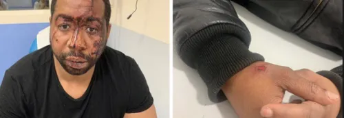 Producteur tabassé : Le parquet réclame la détention et la mise en...