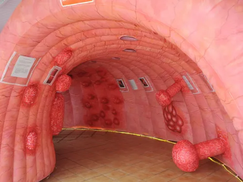 🔊 Sensibilisation au cancer colorectal à l'hôpital